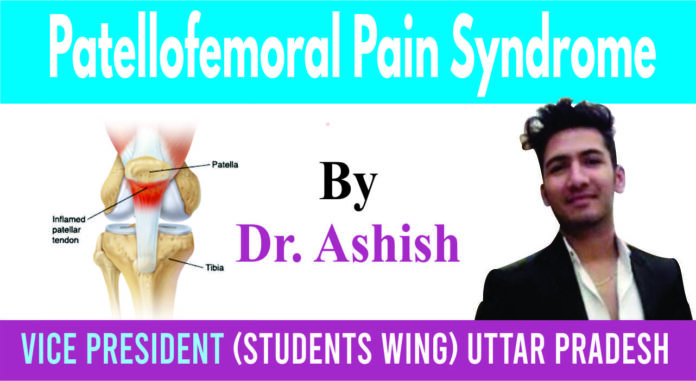 Patellofemoral Pain Syndrome